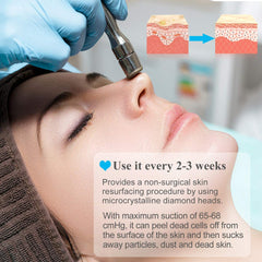 MCWDOIT diamond-heads-collection with interchangeable heads for customized exfoliation