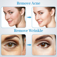 mcwdoit spray gun attachment for hydrating mist during treatments