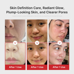 Medicube Age-R Booster Pro Pink USB charging cable included for convenience.