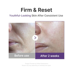 Medicube Retinol Boosting Serum texture swirl shows lightweight, absorbent consistency.