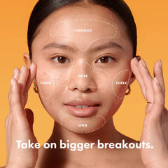 Mighty Patch Face XL patch on the forehead targets larger breakouts effectively.