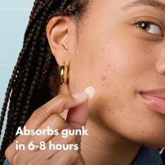 Mighty Patch Invisible+ 12mm patch applied for targeted blemish coverage