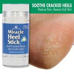 Cracked heel closeup by Miracle of Aloe highlighting deep moisture and texture