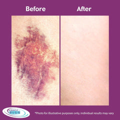 Miracle Plus Horse Chestnut extract shown on packaging