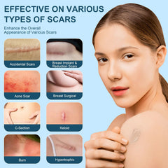 Mitgary formula supports old scar appearance reduction while keeping skin calm.