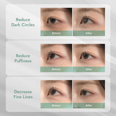 MIZON 24K gold peptide eye patch helps smooth fine lines around eyes.