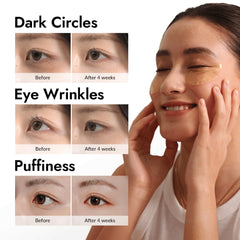 MIZON patches deliver snail mucin nutrition to the eye area.