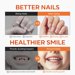 Modelones nail biting prevention for kids shown for easy use