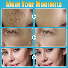 MONESAO Derma Roller Pen for beard area, smooth grooming support.