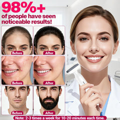 MONESAO Derma Stamp for beard targets micro-areas and improves glide.