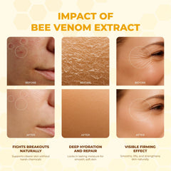 MONIER Bee Venom Cream closeup shows smoother skin texture.