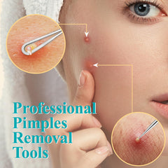 MORGLES curved eyebrow tweezers for precise shaping.