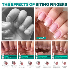 Morovan child applying nail biting polish for safer habits.