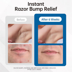 Morovan fast-absorbing serum texture shown, reducing irritation quickly.
