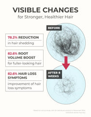 Motifull Hair Boost Ampoule roller on scalp for targeted thinning-area care