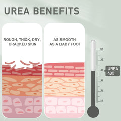 Mouriven Urea Cream 40% applying to heel showing exfoliating action for dry skin