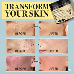 Applying MTGBO Beef Tallow Honey Balm on the face for quick absorption