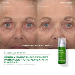 Murad Retinal ReSculpt refill bottle fits into your existing bottle.