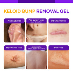 MURASAKI BEAUTY Keloid Bump Gel applied to the ear for gentle bump care