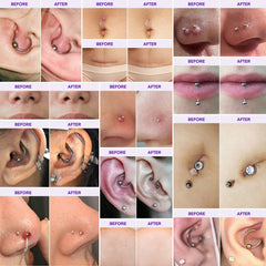 MURASAKI BEAUTY Keloid Bump Removal Gel tube for smoothing texture and renewal