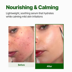 NACIFIC Cica PDRN serum texture drop demonstrating lightweight, quick-absorb feel