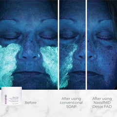 NassifMD Detox Pads sheets show gentle exfoliation for smoother skin texture.