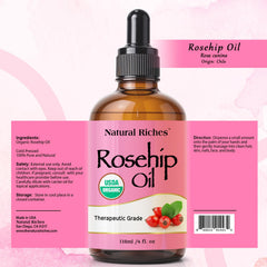 Natural Riches rosehip seed oil with pipette for precise application.