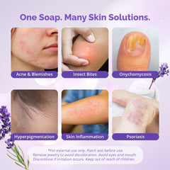 Naturasil sulfur lavender soap bar wart treatment close-up