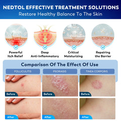 Nedtol non-greasy formula absorbs quickly for daily use.