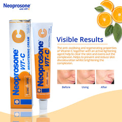 Neoprosone cream applied on cleansed skin showing quick absorption.