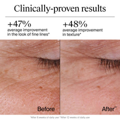 Neutrogena Rapid Wrinkle Repair bottle highlighting hyaluronic acid