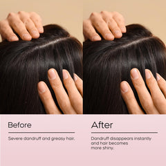 A close-up of NEWREY shows daily-use anti-dandruff shampoo with a rich lather.