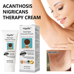 Nigrifix therapy cream applied to underarm area for even tone.