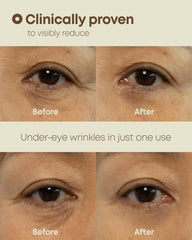 NINELESS Ever-Youth eye cream second skin film-forming layer around the under-eye area for subtle lift