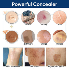NOBA Tattoo Cover Up skin-blemish concealment for tattoos, scars, and spots
