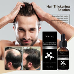 NOLUVA premium packaging box shown for discreet hair restoration at home