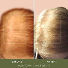 NOOR HAIR ingredient panel highlighting biotin and zinc for follicles.