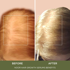 NOOR HAIR Wonder Growth cynatine keratin supports stronger hair fibers
