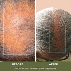 NOOR HAIR Wonder Growth ingredients green coffee bean for natural vitality