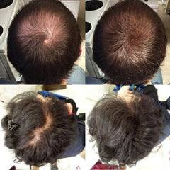 Nor1 Keratin Hair Fibers application close-up showing easy use on thinning spots