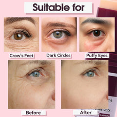 Nuckhuce balm for eyes demonstrates gentle firming support around the eye area.