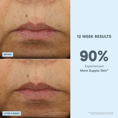 NuFACE peptide complex graphic represents multi-peptide action on fine lines