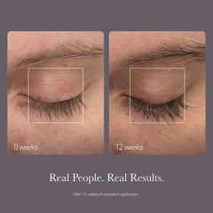 Product display with clinical trial imagery indicating science-backed lash support.