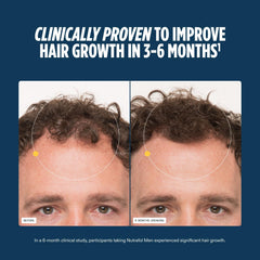 Nutrafol Men blend of 21 vitamins and minerals for hair health