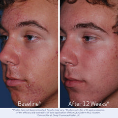 Obagi CLENZIderm MD therapeutic system packaging shows 3-step skincare.
