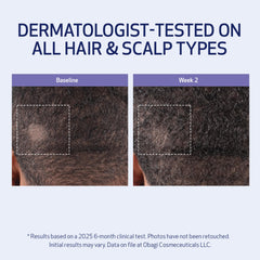 Obagi Nu-Cil BioStim scalp application area showing targeted treatment