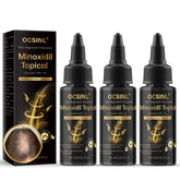 OCSINL minoxidil bottle with precision dropper for targeted scalp application.