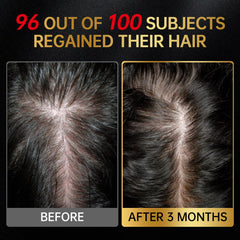 OCSINL minoxidil packaging detail for high-quality labeling.
