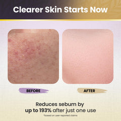 Okaga White Rice Peel Shot daily renewal image showing gentle exfoliation and calm skin.