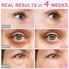 Omplen under-eye area brightening with niacinamide and caffeine benefits.